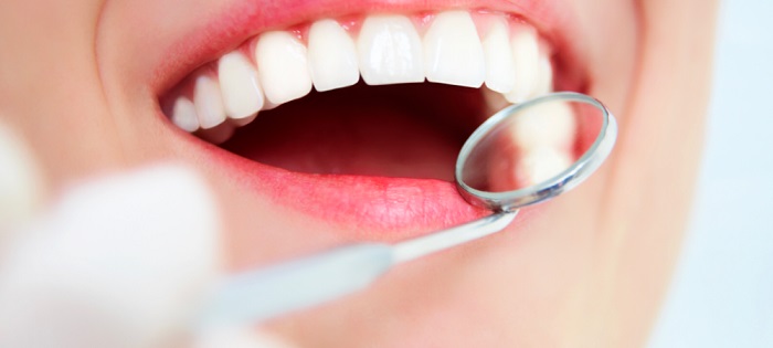 giảm giá trồng răng Implant