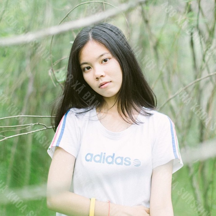 niềng 1 cái răng cửa