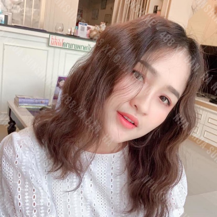 niềng răng 1 hàm mất bao lâu