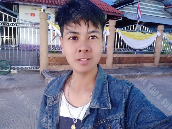 niềng răng 4 năm