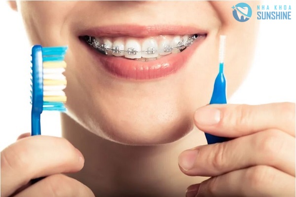 niềng răng bao lâu hết đau