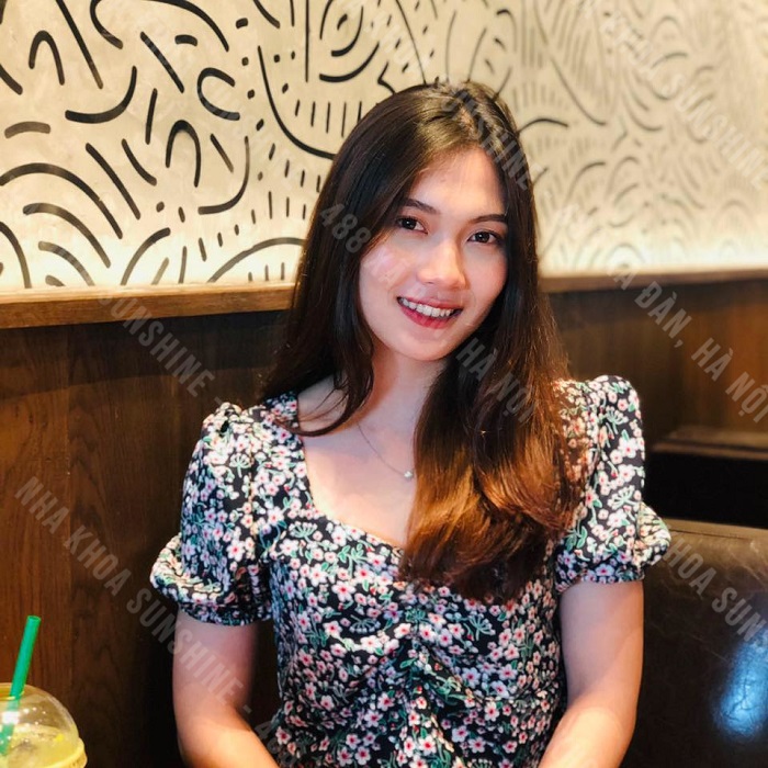 niềng răng chỗ nào đẹp niềng răng chỗ nào đẹp