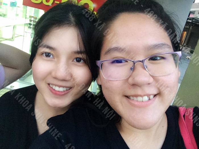 niềng răng cho trẻ em giá bao nhiêu niềng răng cho trẻ em giá bao nhiêu