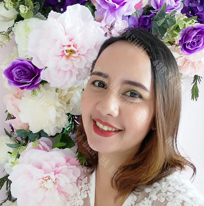 niềng răng có mấy loại