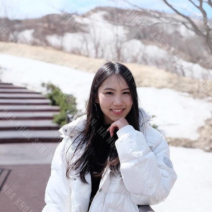 niềng răng cửa hô