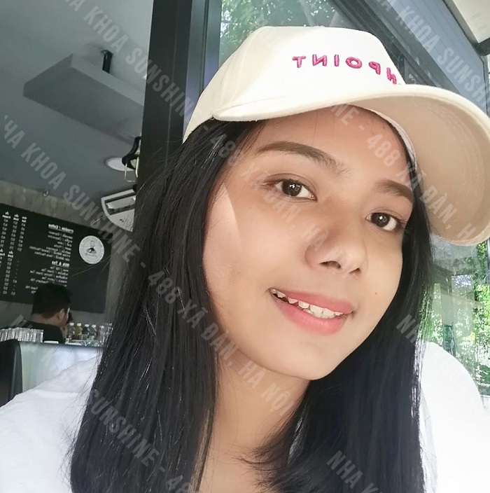 niềng răng không được ăn gì niềng răng không được ăn gì