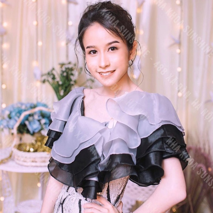 niềng răng xong có đẹp hơn không
