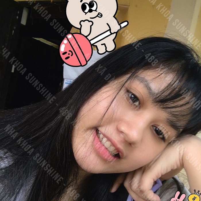 trồng răng giả có lâu không