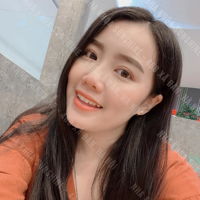 trồng răng hàm Implant giá bao nhiêu trồng răng hàm Implant giá bao nhiêu