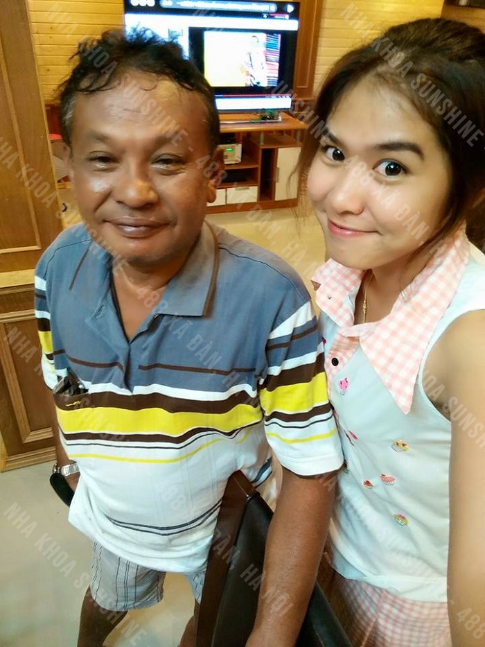trồng răng Implant all on 6 trồng răng Implant all on 6