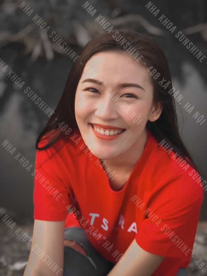 trồng răng Implant là gì