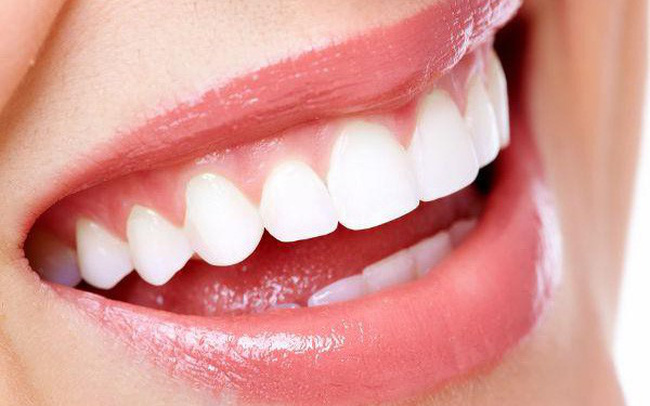 trồng răng Implant là gì