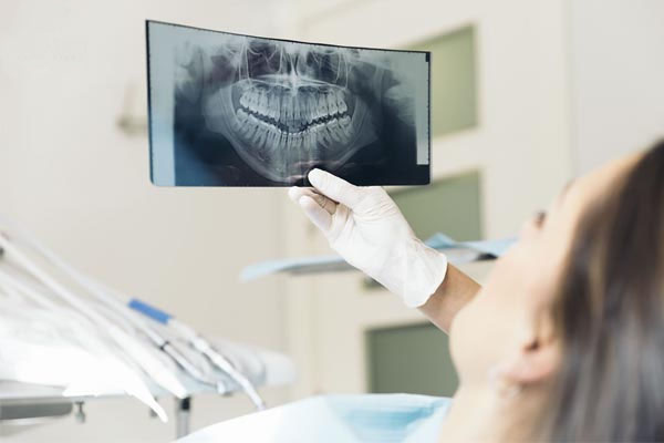 trồng răng Implant mất thời gian bao lâu