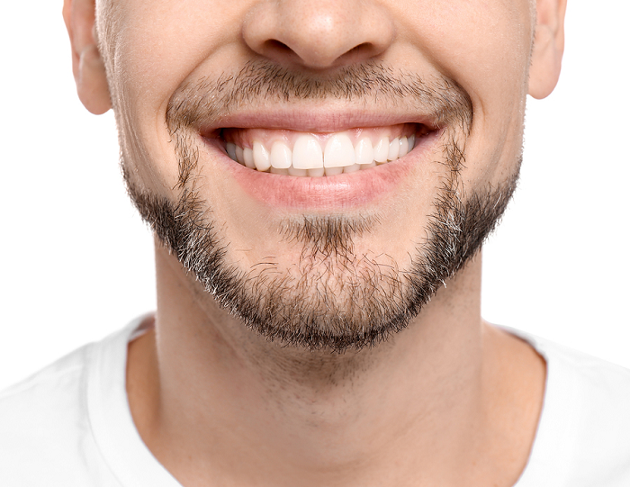 trồng răng Implant trả góp