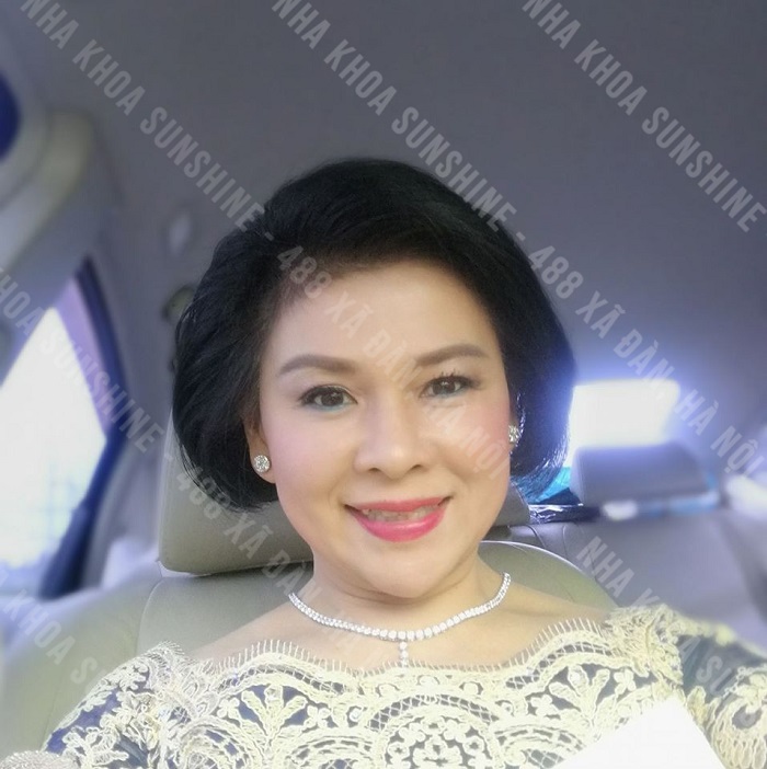trồng răng Implant trong bao lâu