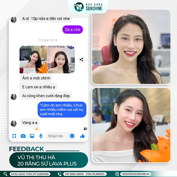 Cách làm trắng răng bằng baking soda Cách làm trắng răng bằng baking soda