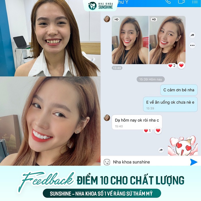 Cách làm trắng răng bằng baking soda Cách làm trắng răng bằng baking soda