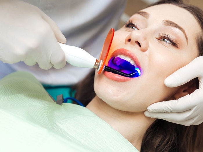Làm trắng răng bằng laser có hại không