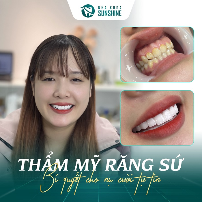 Hướng dẫn sử dụng bột làm trắng răng eucryl Hướng dẫn sử dụng bột làm trắng răng eucryl