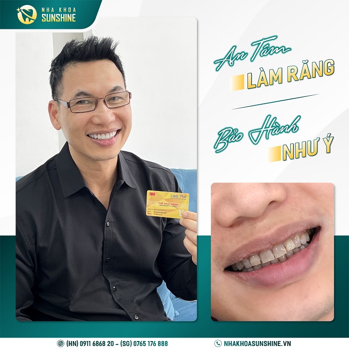 Cách làm trắng răng cho người hút thuốc lá