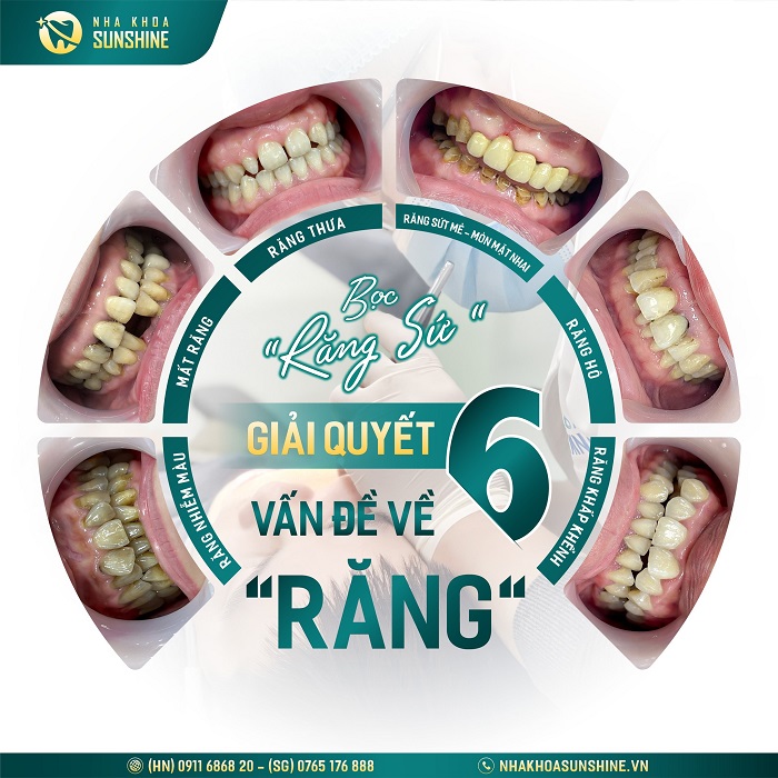 Bút tẩy trắng răng giá bao nhiêu