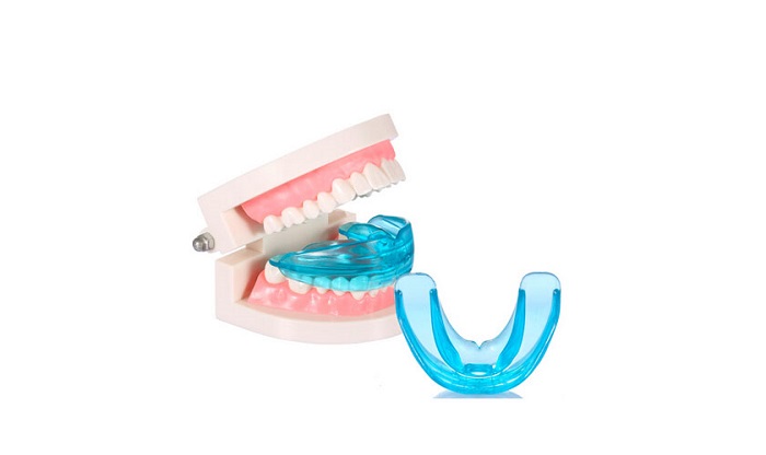 dụng cụ niềng răng trong suốt dụng cụ niềng răng trong suốt
