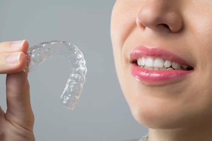 niềng răng tháo lắp Clear Aligner
