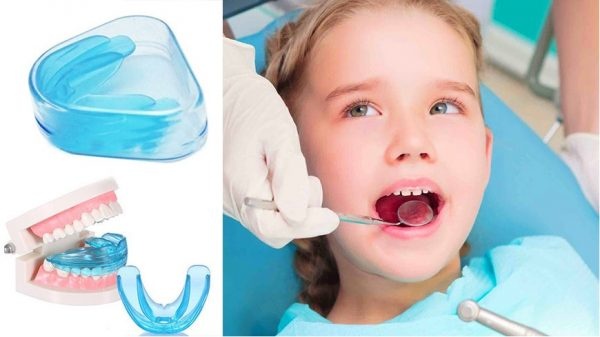 Niềng răng cho trẻ ở đâu tốt