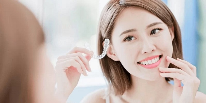 Niềng răng trong suốt Hàn Quốc