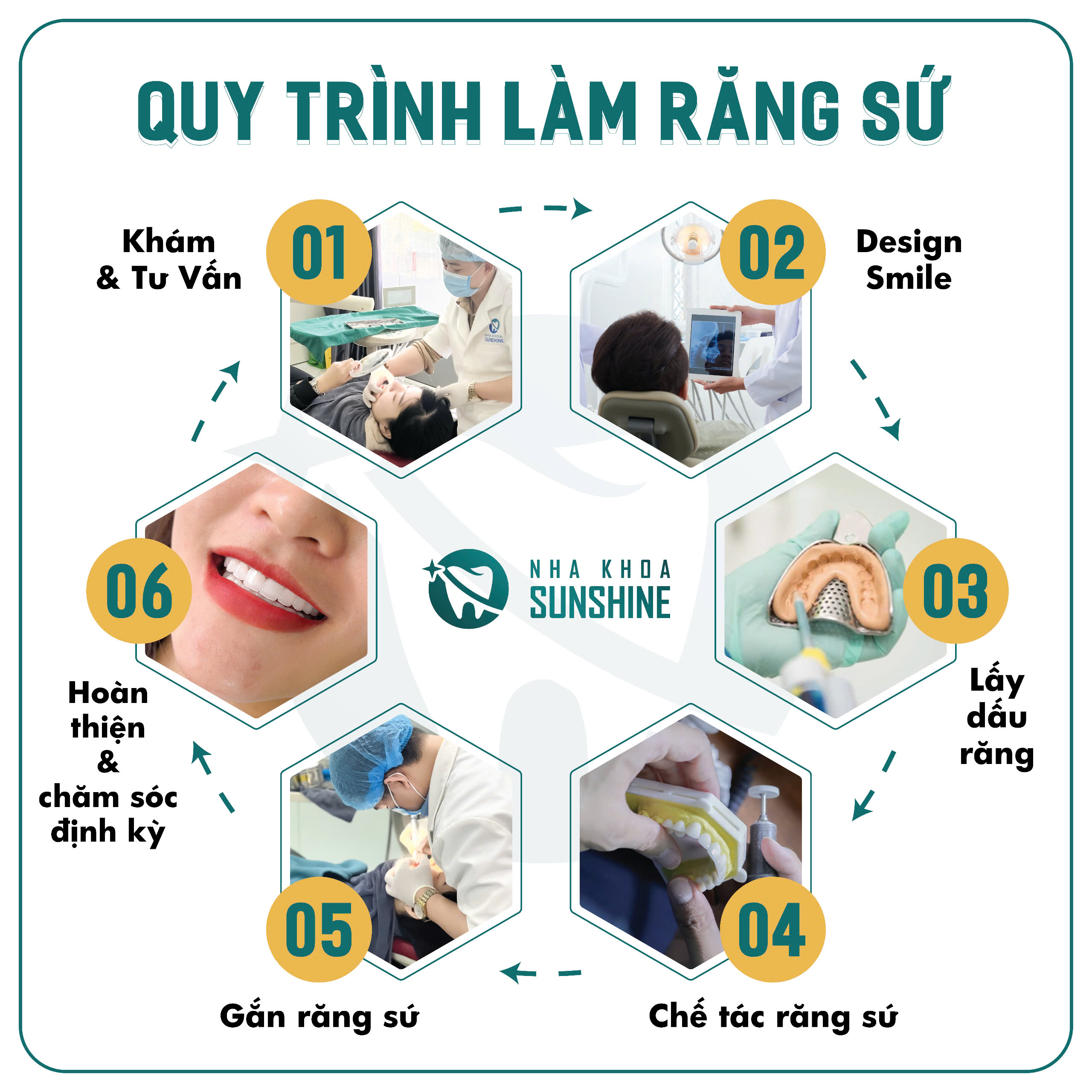 Quy trình làm răng sứ thẩm mỹ
