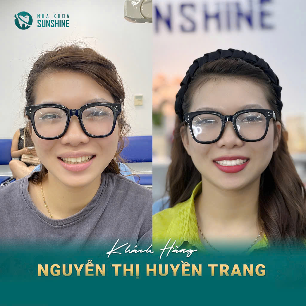 tay-trang-rang-cong-nghe-whitemax4.0-hieu-qua