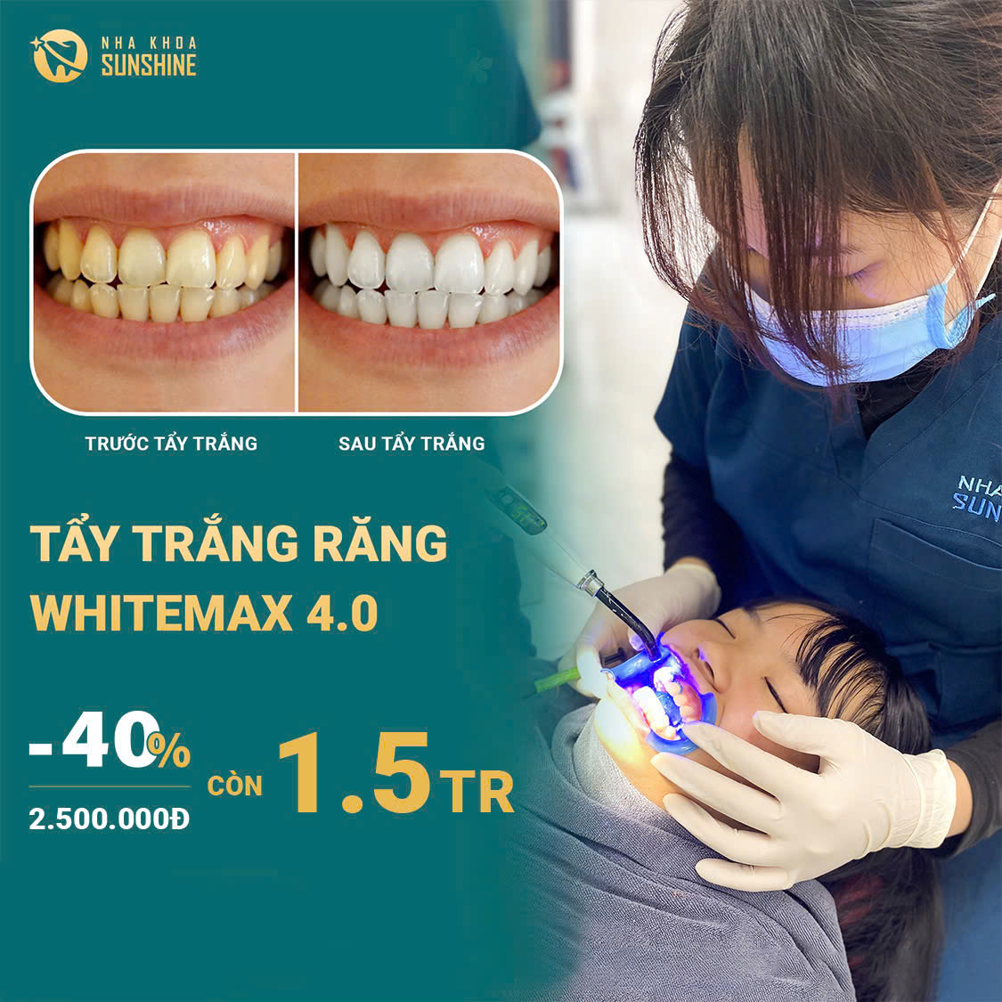 tay-trang-rang-cong-nghe-whitemax4.0-hieu-qua