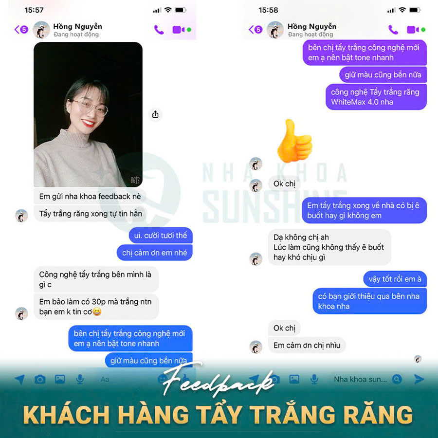 tay-trang-rang-cong-nghe-whitemax4.0