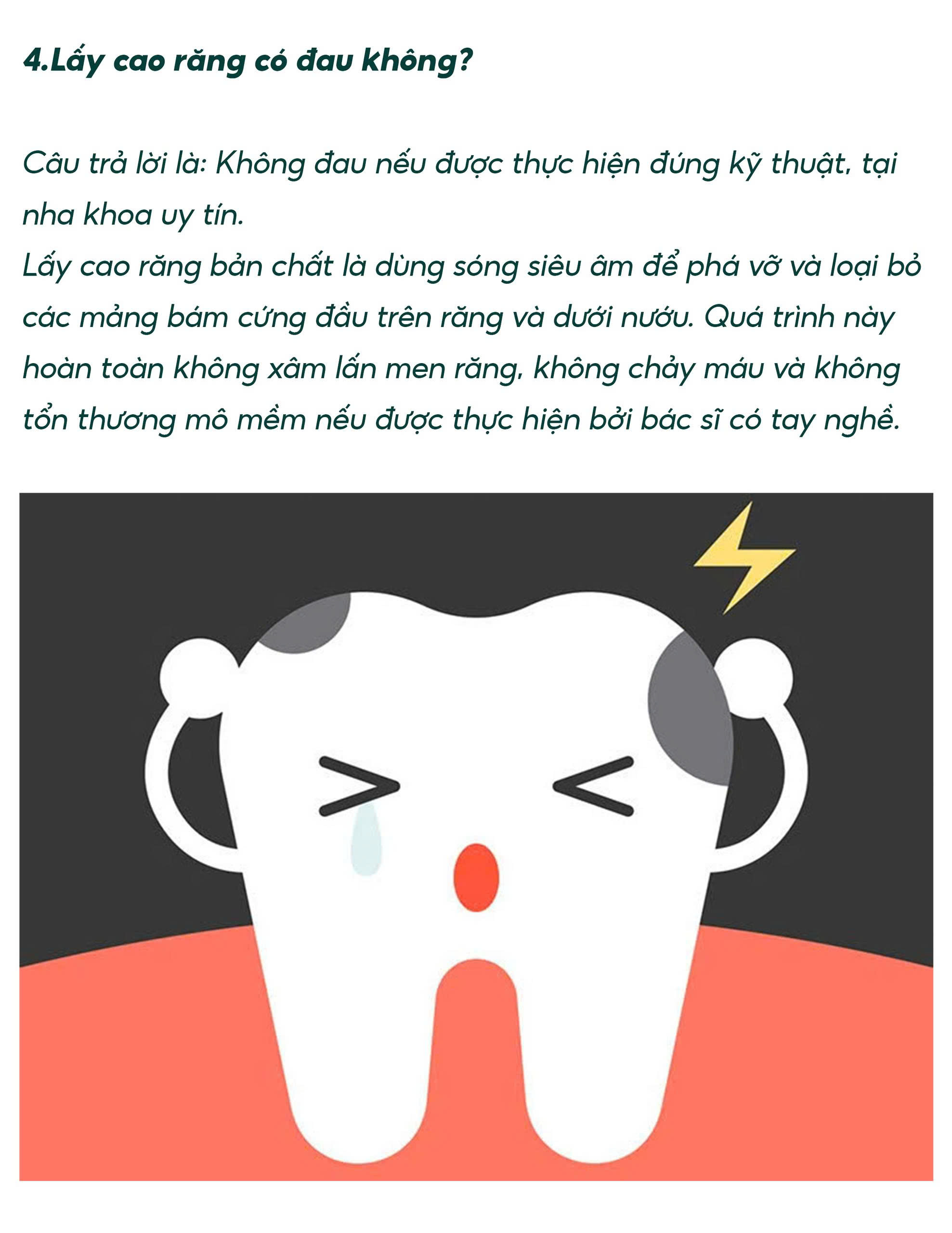 Lấy cao răng