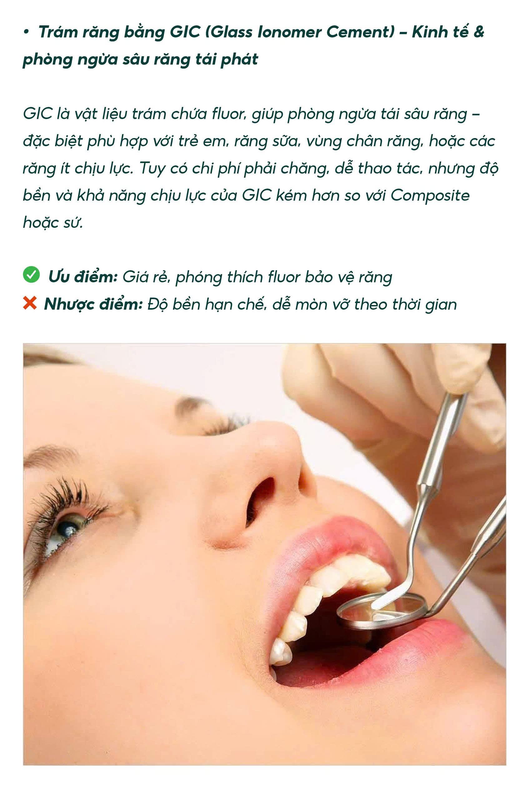 Trám Răng