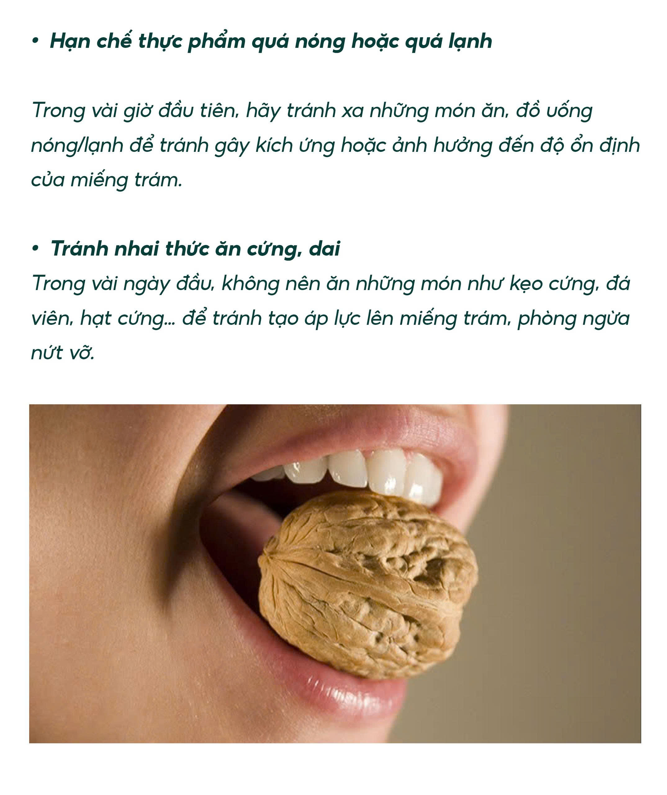 Trám Răng
