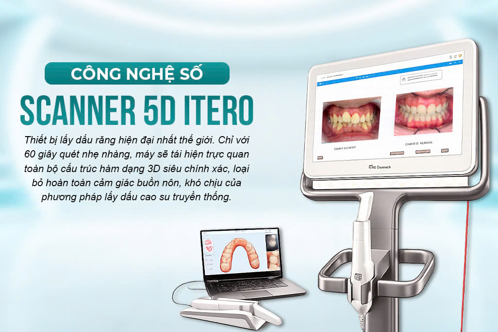 Công Nghệ Số Scanner 5D iTero