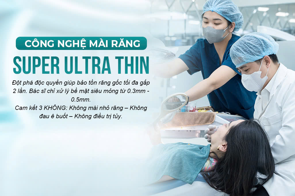Công Nghệ Mài Răng Super Ultra Thin