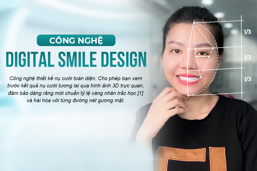Công Nghệ Digital Smile Design