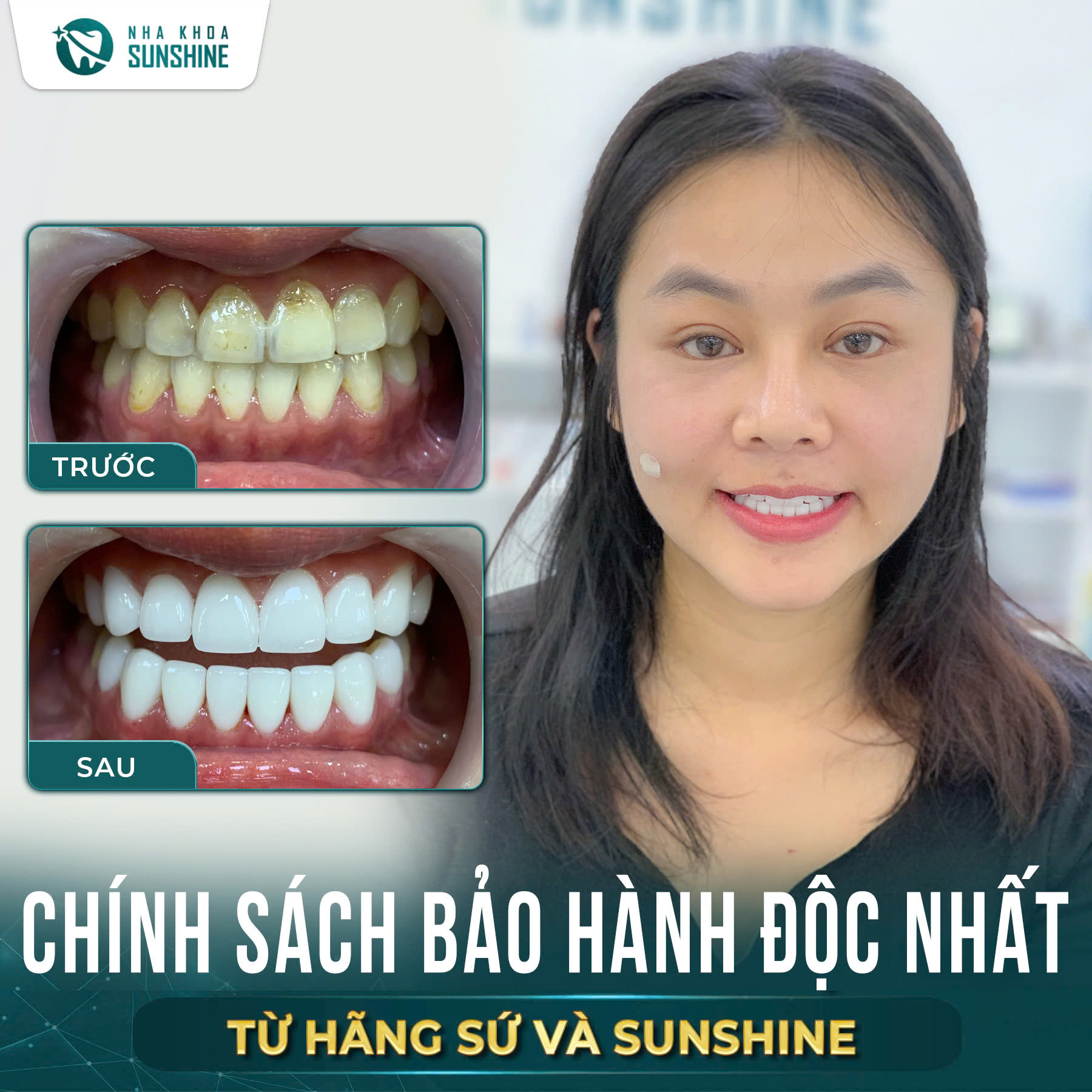 Khách hàng hoàn thiện dáng răng Orodent