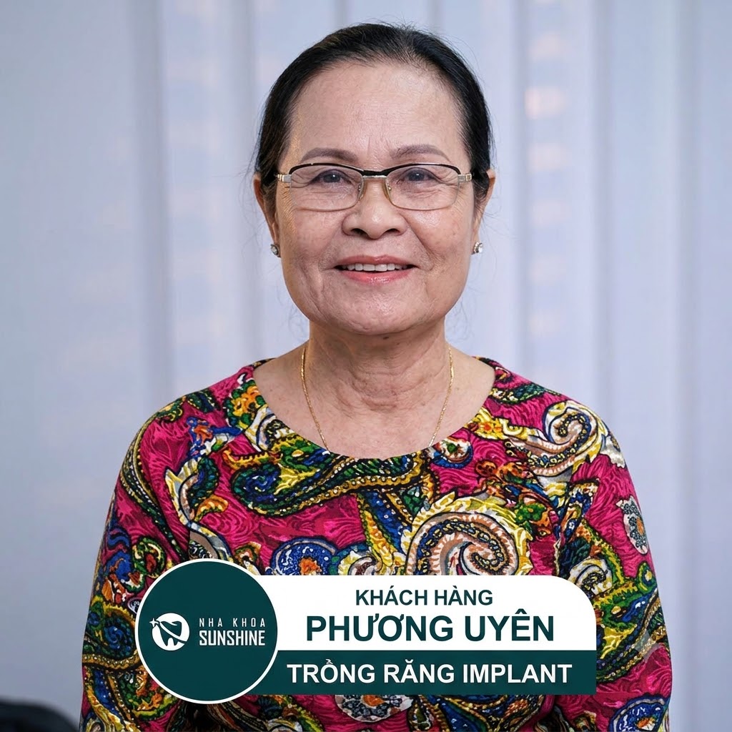 Khách hàng phục hồi mất răng hàm