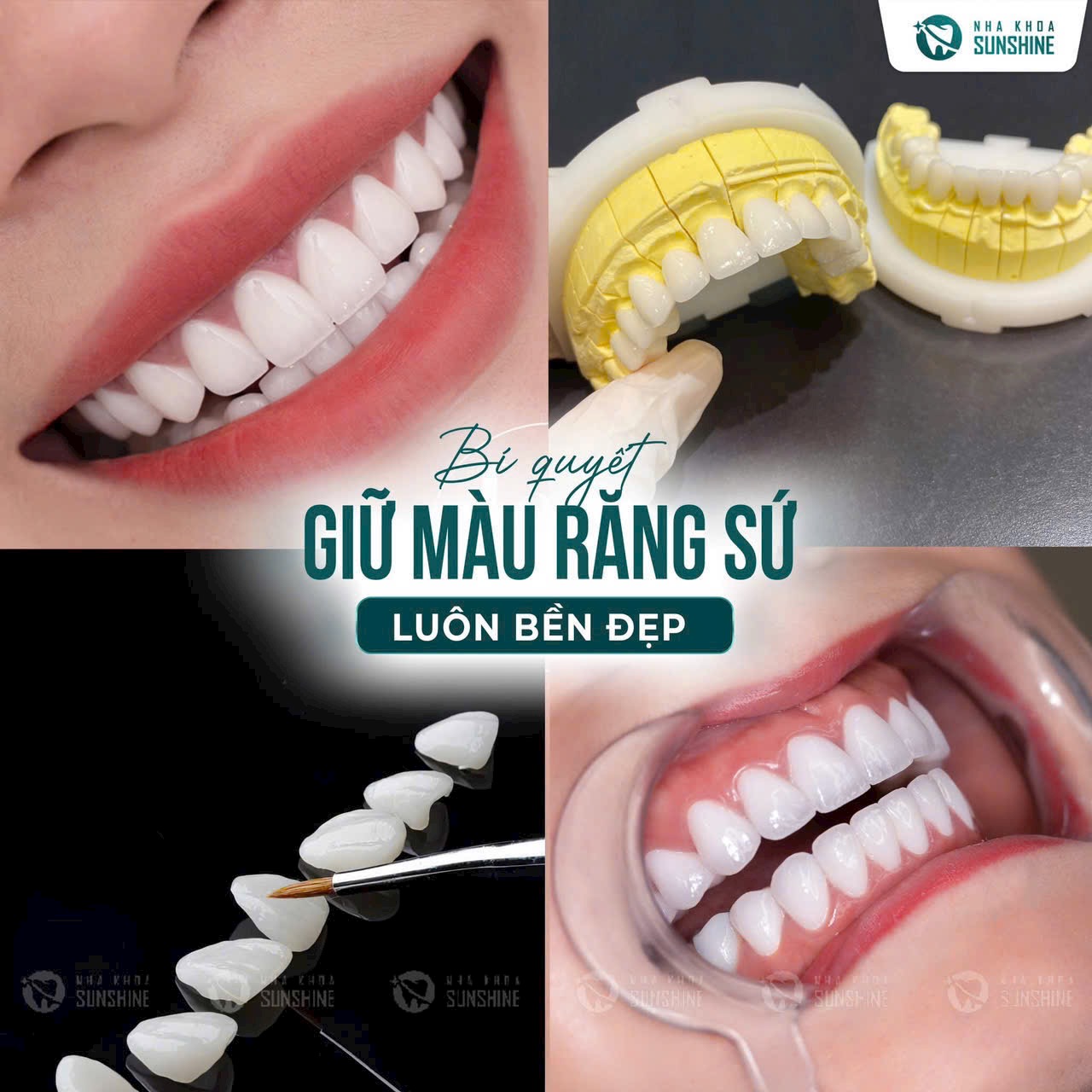 Đại Tiệc Răng Sứ Tháng 8 - Nha Khoa Sunshine