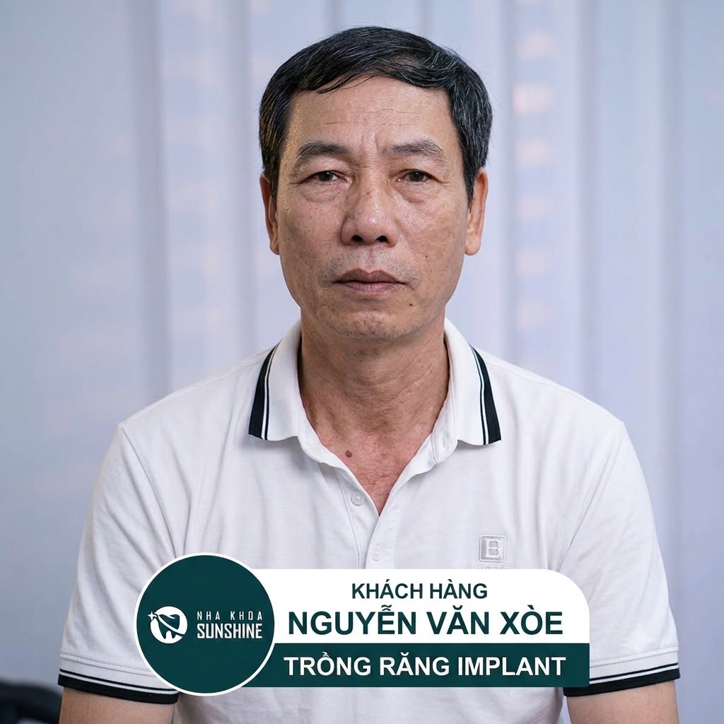 Khách hàng kiều bào trồng răng toàn hàm
