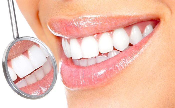 răng sứ cercon là gì